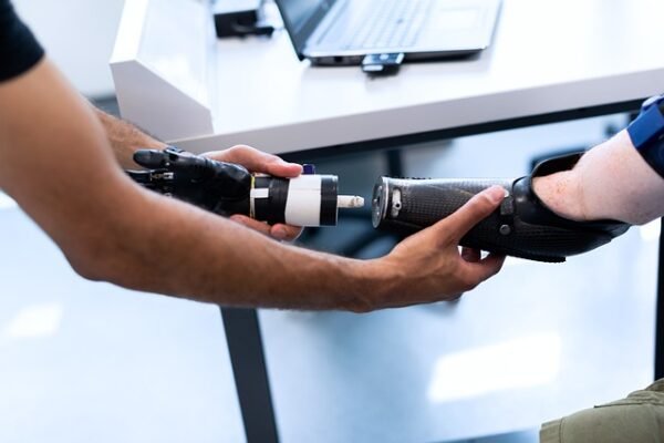 Bionic Limbs in 2025-2030: Are We Closer to Fully Functional Cybernetics