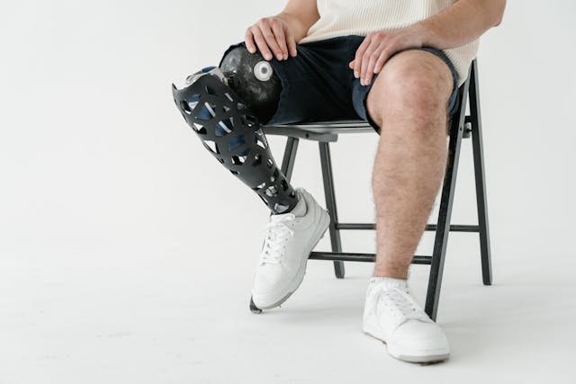 Discover how 3D printing is making prosthetics more affordable and customizable for children with congenital limb loss. A game-changer in accessibility