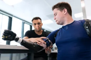 Delaying prosthetic fitting may lead to poor posture, abnormal gait, and chronic pain. Learn how early fitting supports proper alignment and long-term mobility.