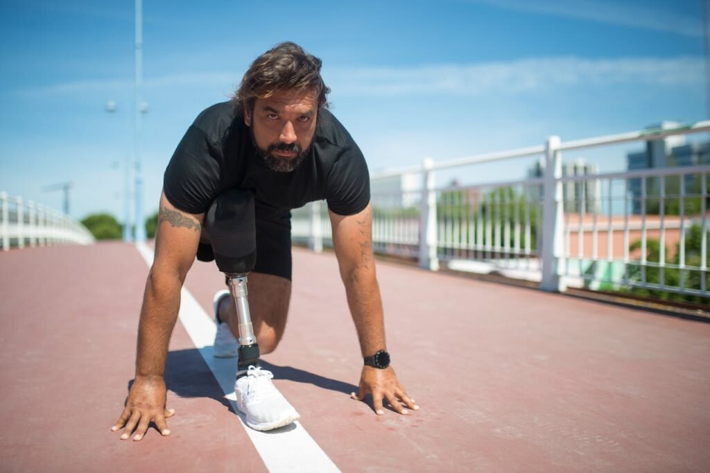 Every prosthetic must be custom fitted.