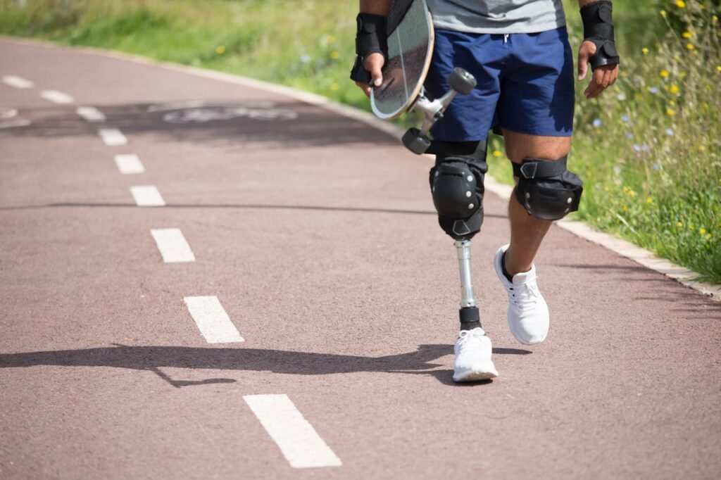The journey doesn’t end when you get your prosthetic foot