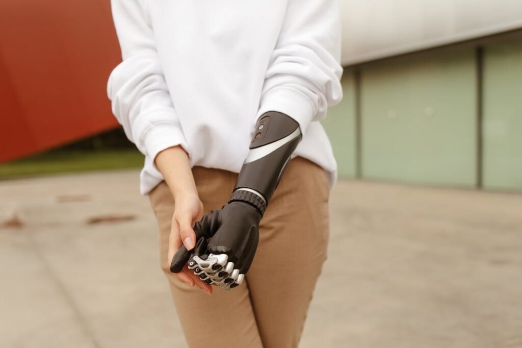 Myoelectric prosthetics run on the natural signals from your muscles