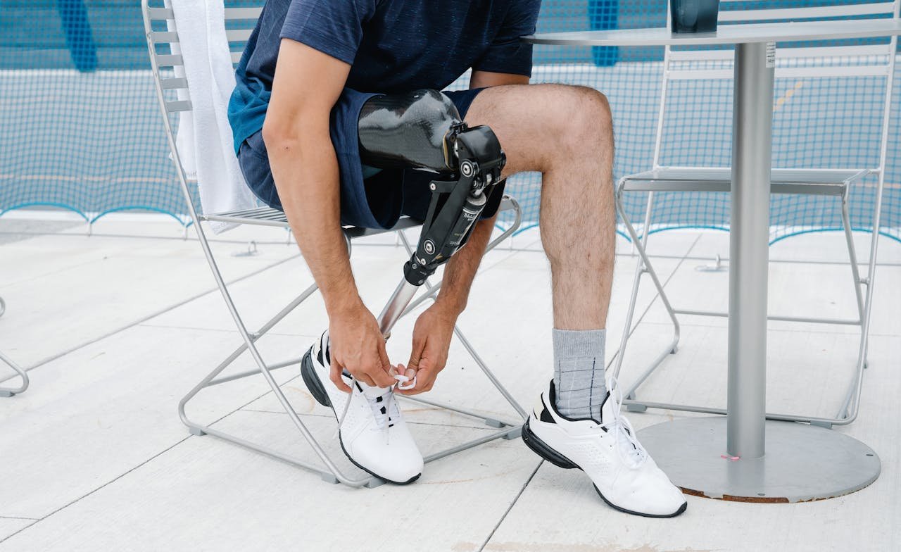 From Prosthetic Trial to Daily Use: How Quickly Can You Start?