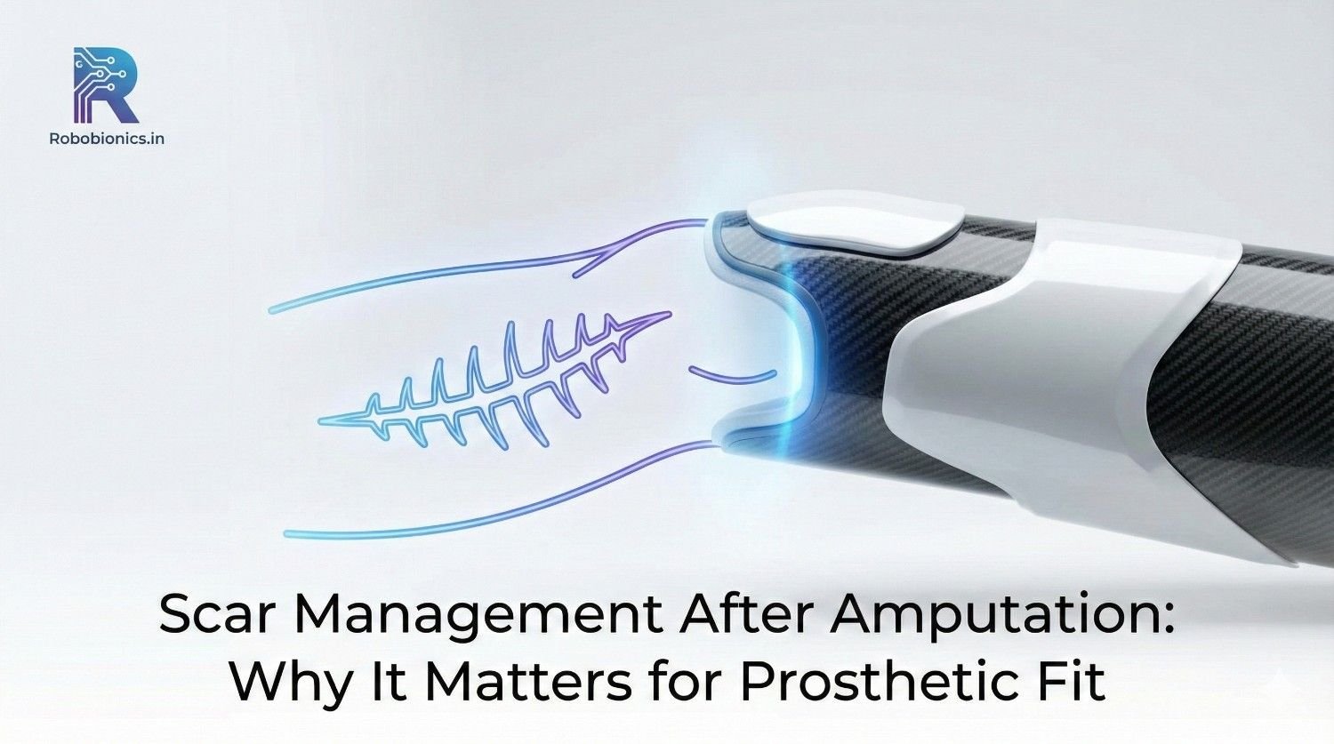 Scar Management After Amputation: Why It Matters for Prosthetic Fit